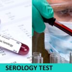 Serological Diagnosis Of Infections