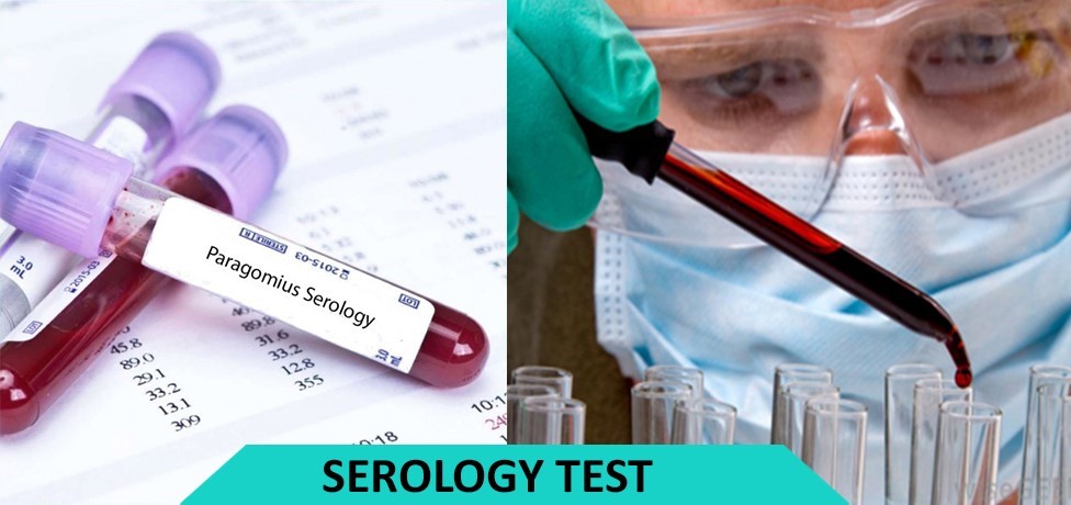 Serology in a medical laboratory