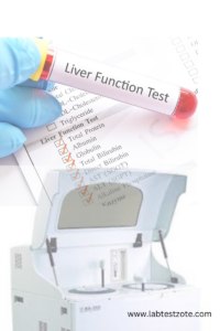 Liver Function Test-labtestzote.com