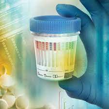 Urine Drugs Test