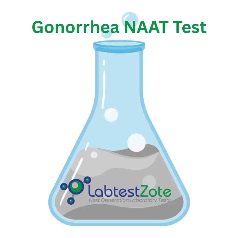 Gonorrhea NAAT Test