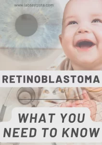 Retinoblastoma Post Graphic -labtestzote.com