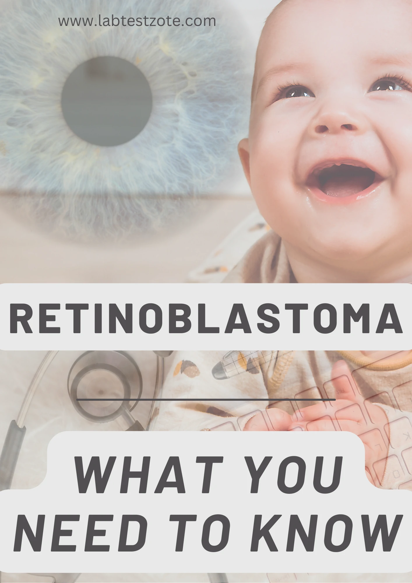 Retinoblastoma Post Graphic -labtestzote.com