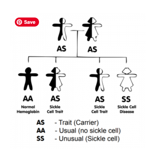 Sickle Cell Disease