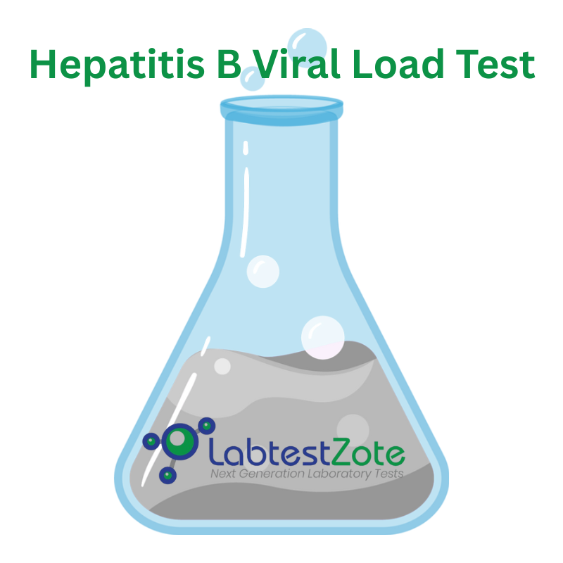 Hepatitis B Viral Load Test