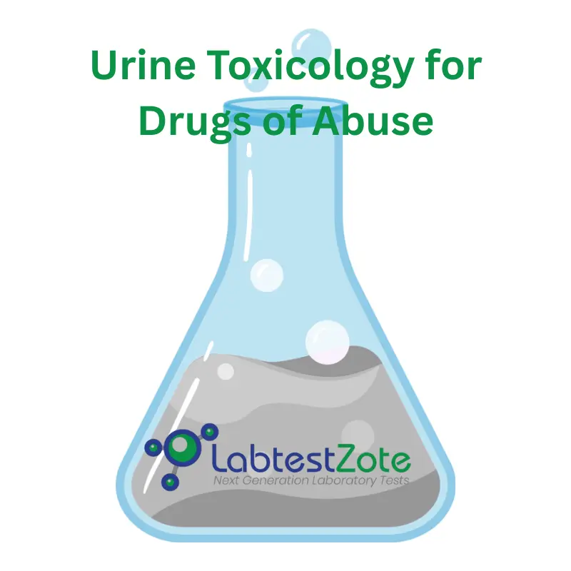 Drugs of Abuse Test -10 Panel Urine Test