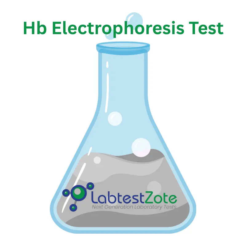 Hb Electrophoresis Test