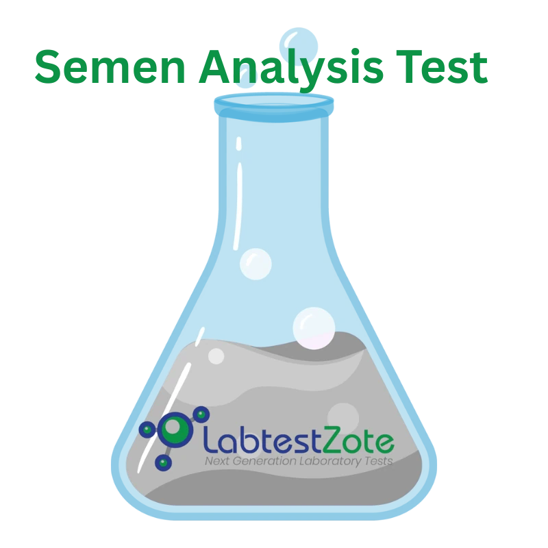 Semen Analysis Test