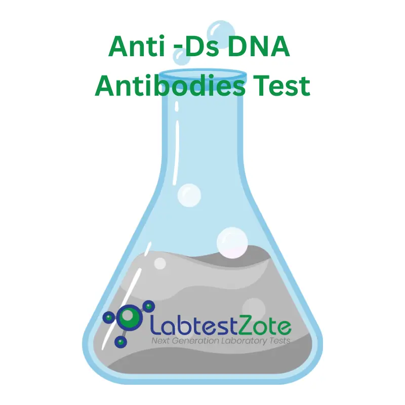 Anti Ds DNA Antibodies Test