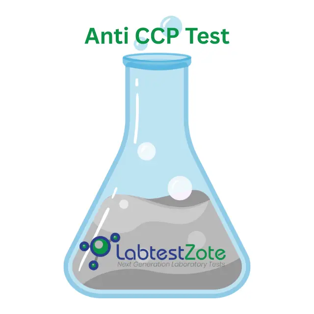 Anti CCP Test